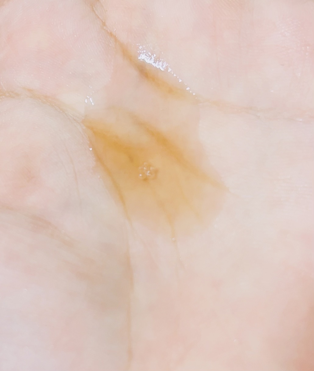 RXザ・アルファアルブチン2 ニキビ跡ケアセラム/COSRX/美容液を使ったクチコミ（3枚目）