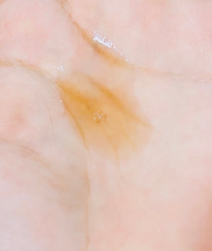 RXザ・アルファアルブチン2 ニキビ跡ケアセラム/COSRX/美容液を使ったクチコミ(3枚目)