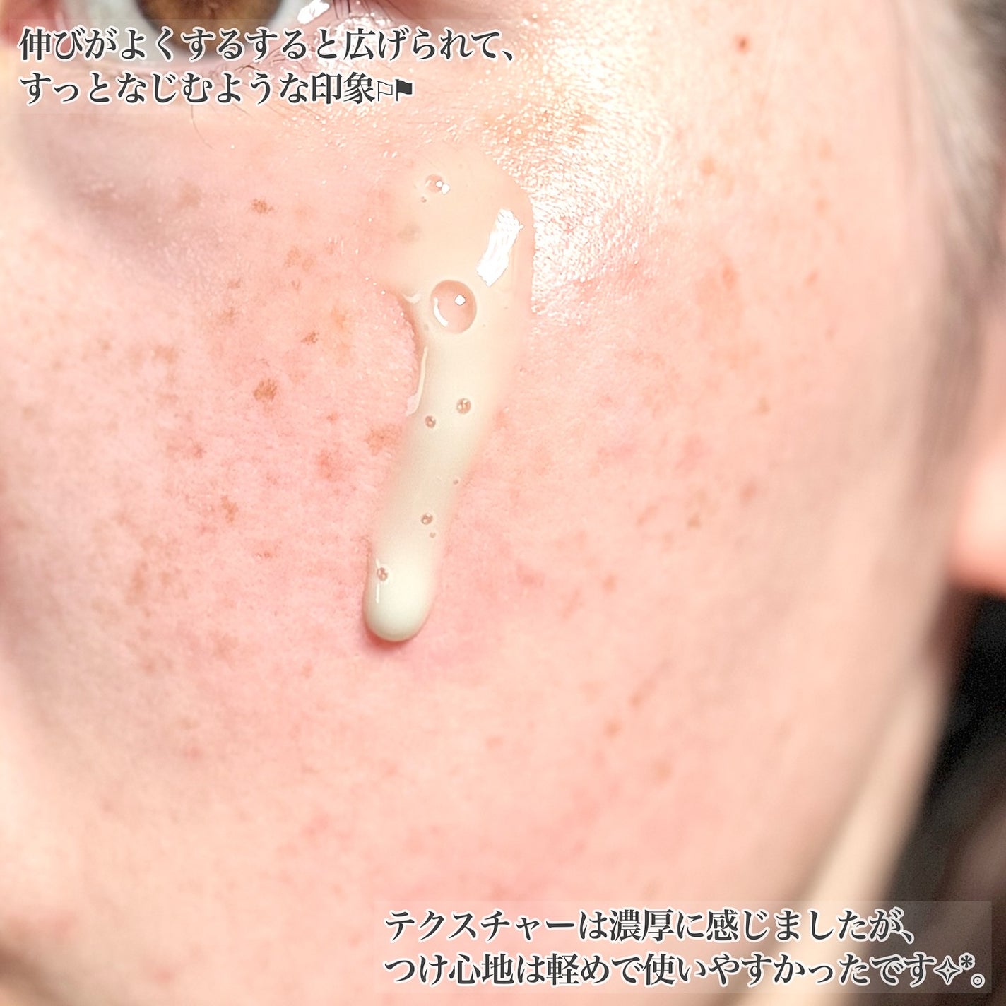 ReDRNエクソソームアンプル/Dr.nineteen/美容液を使ったクチコミ(5枚目)