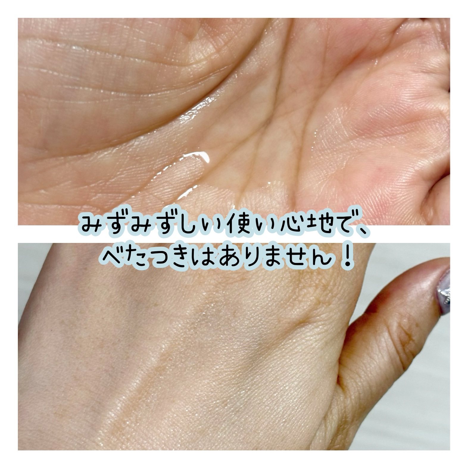 タカミスキンピール/タカミ/ブースター・導入液を使ったクチコミ（2枚目）