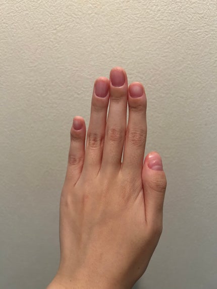 ボタニカルネイルオイル/キャンメイク/ネイルオイル・トリートメントを使ったクチコミ(1枚目)