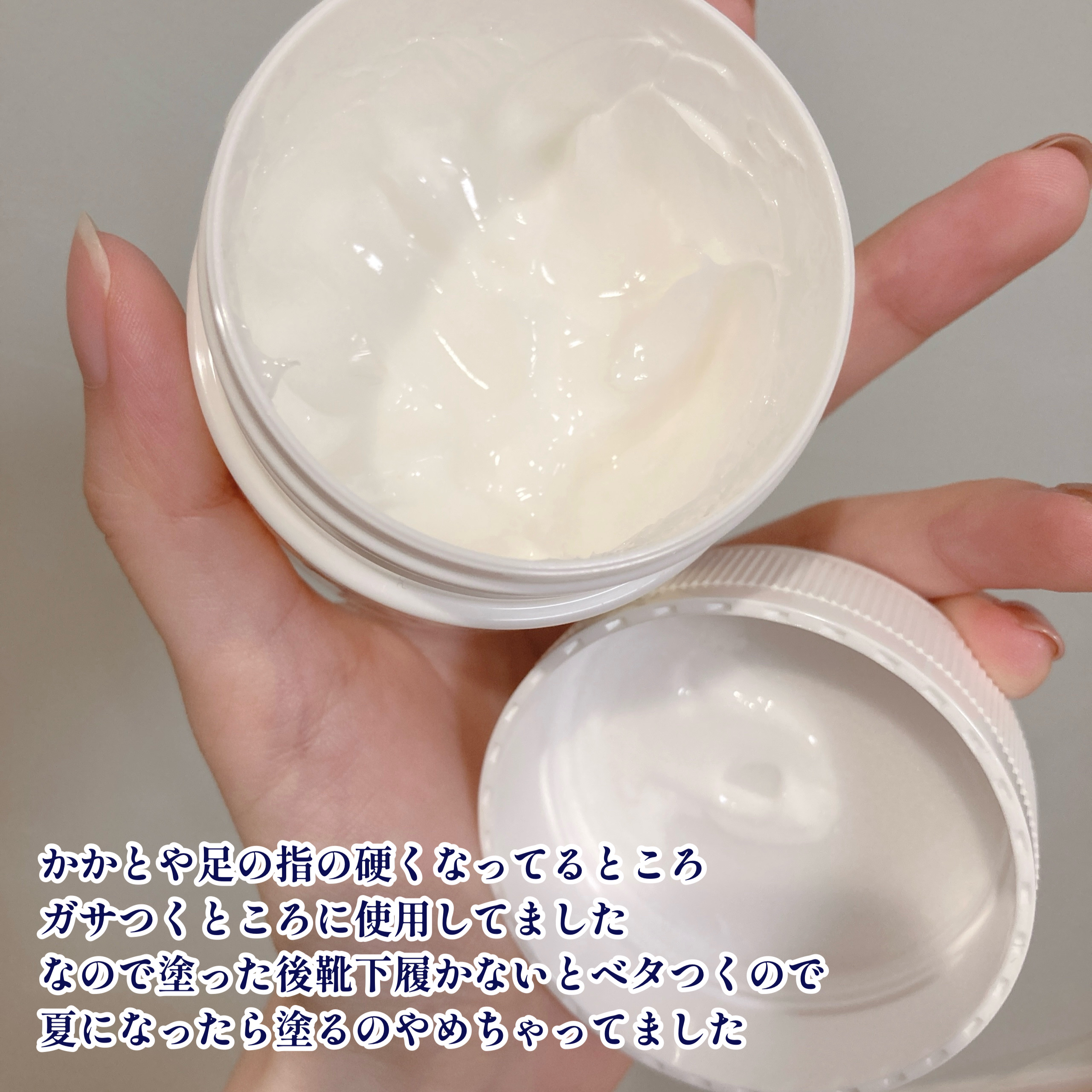 やわらか素肌クリームU (第3医薬品)/メンソレータム/その他を使ったクチコミ（2枚目）