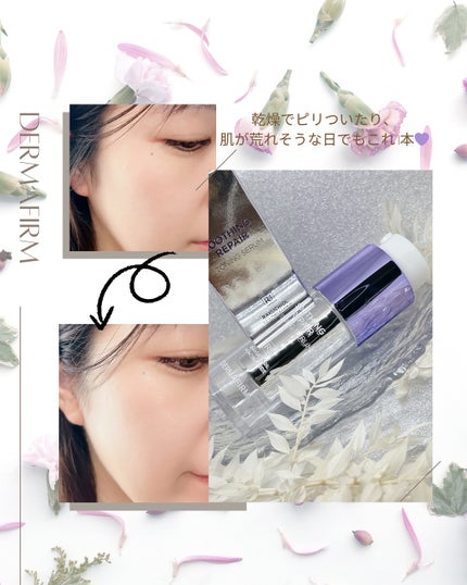 SOOTHING REPAIR TONING SERUM R4/ダーマファーム/美容液を使ったクチコミ(4枚目)