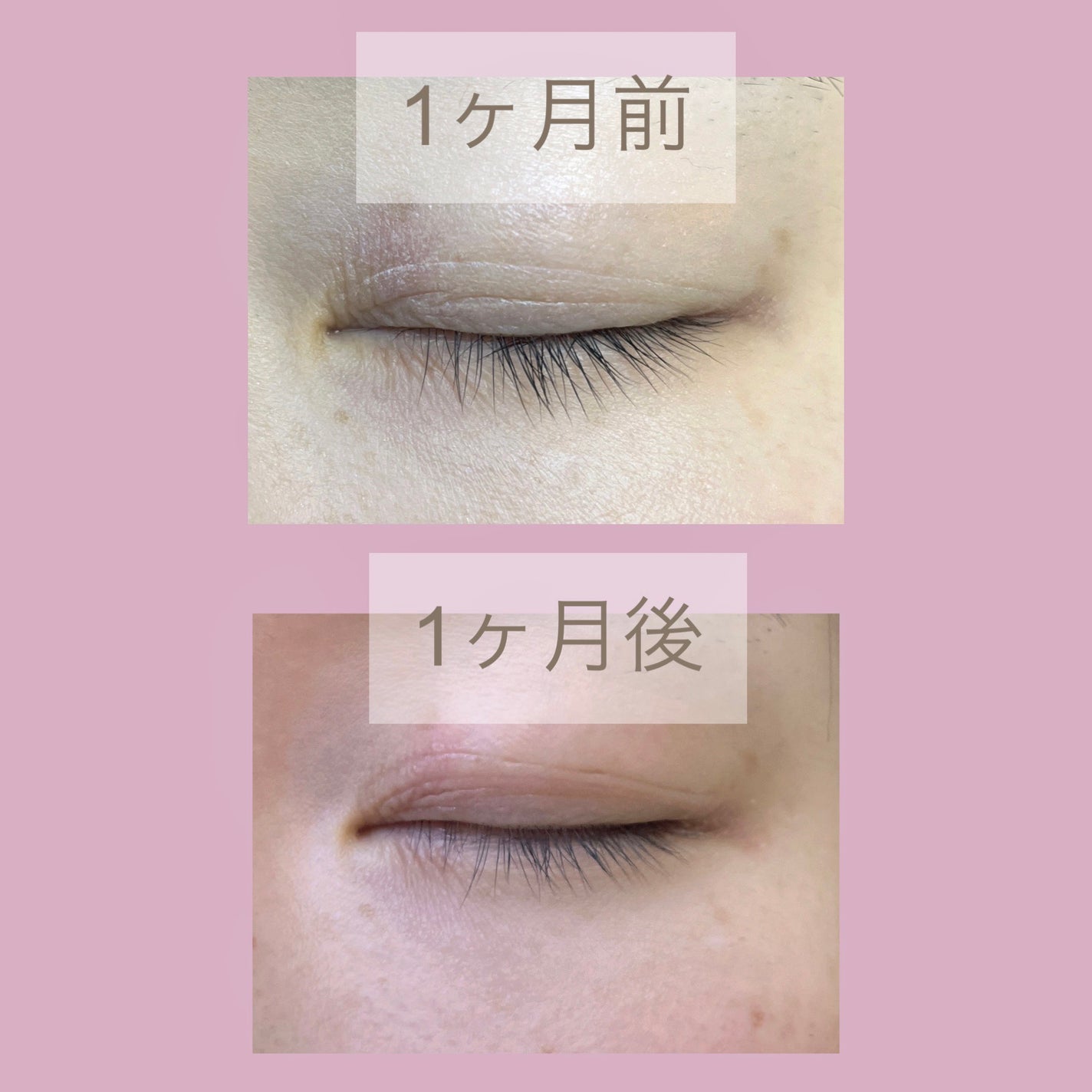 ラッシュリッチアイラッシュセラム/ロート製薬/まつげ美容液を使ったクチコミ(2枚目)