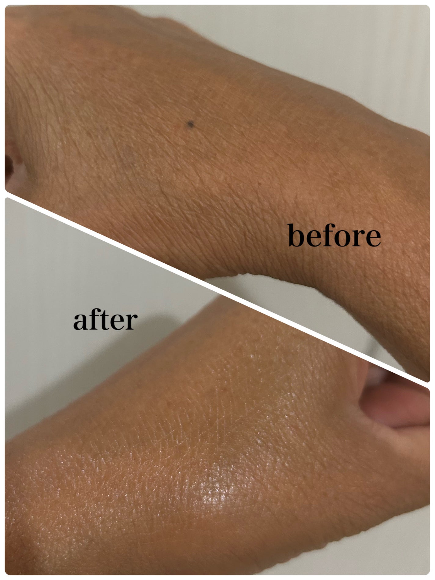 リードルS PDRN+ セラム/VT/美容液を使ったクチコミ(4枚目)