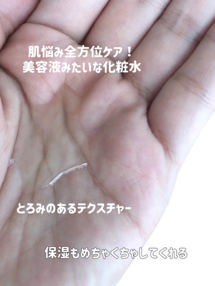 ダーマレーザー スーパーVC100ローション(しっとり)/クオリティファースト/化粧水を使ったクチコミ(3枚目)