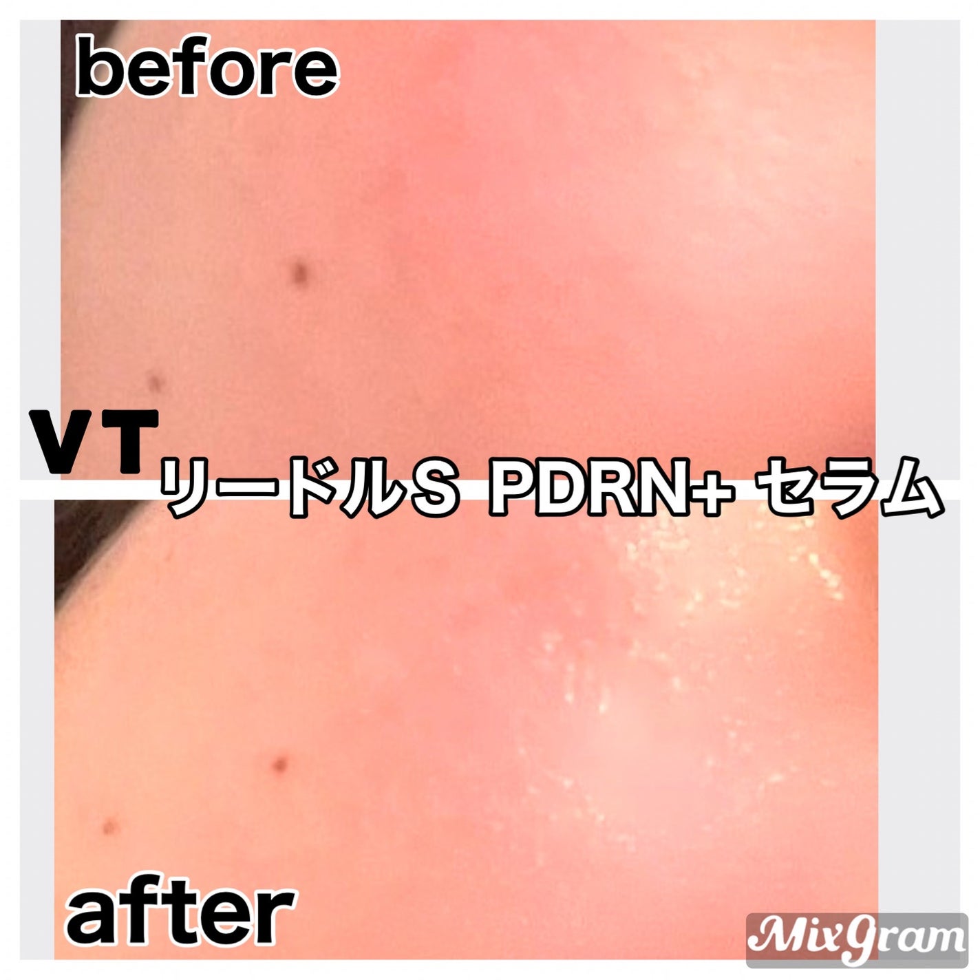 リードルS PDRN+ セラム/VT/美容液を使ったクチコミ(2枚目)