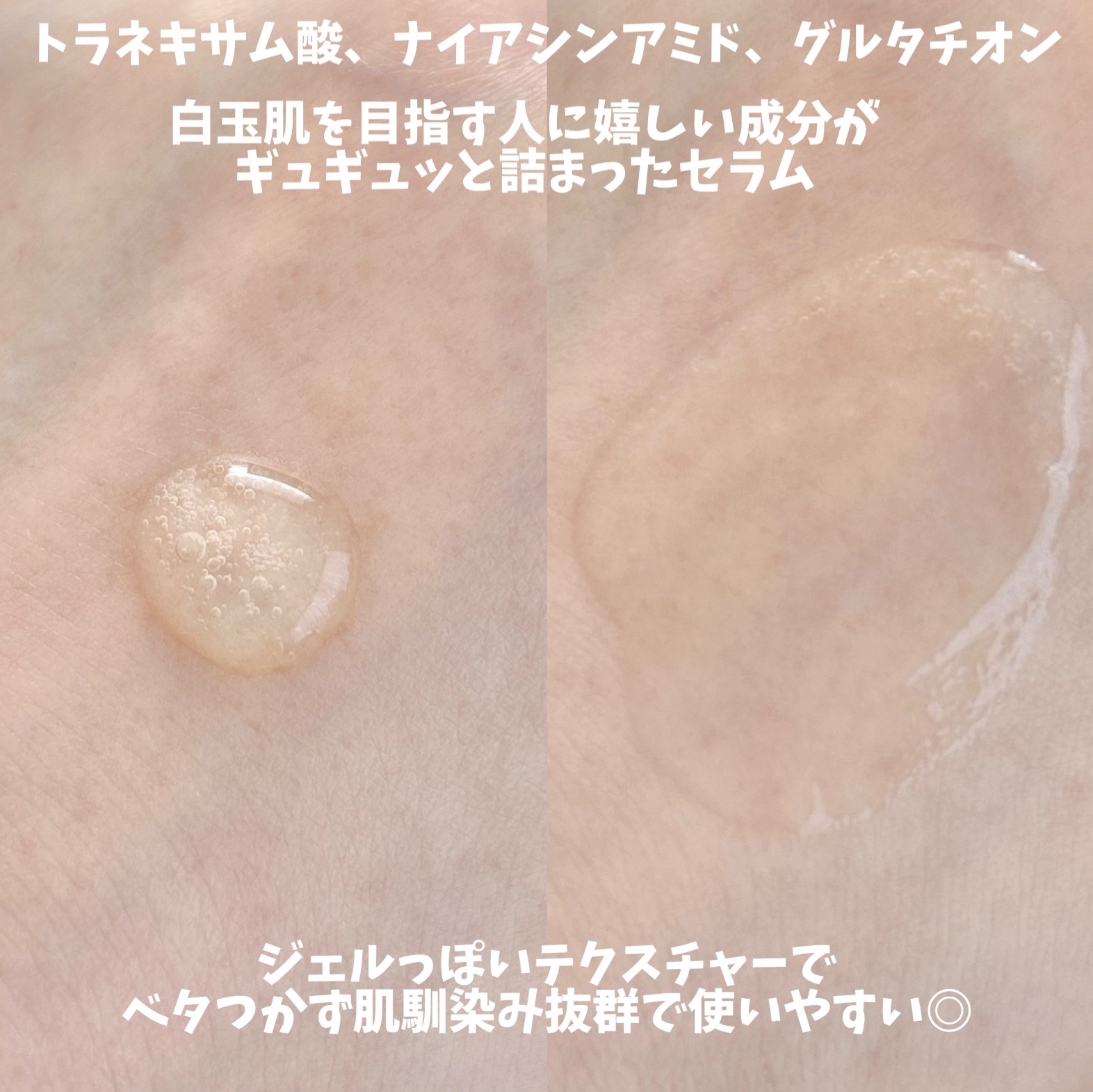 トラネキサム酸10％ブライトニングセラム/Real Barrier/美容液を使ったクチコミ（3枚目）