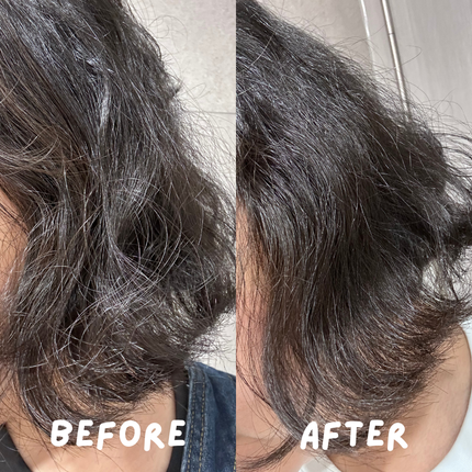 フォルテ アンプル トリートメント/treecell/洗い流すヘアトリートメントを使ったクチコミ(4枚目)