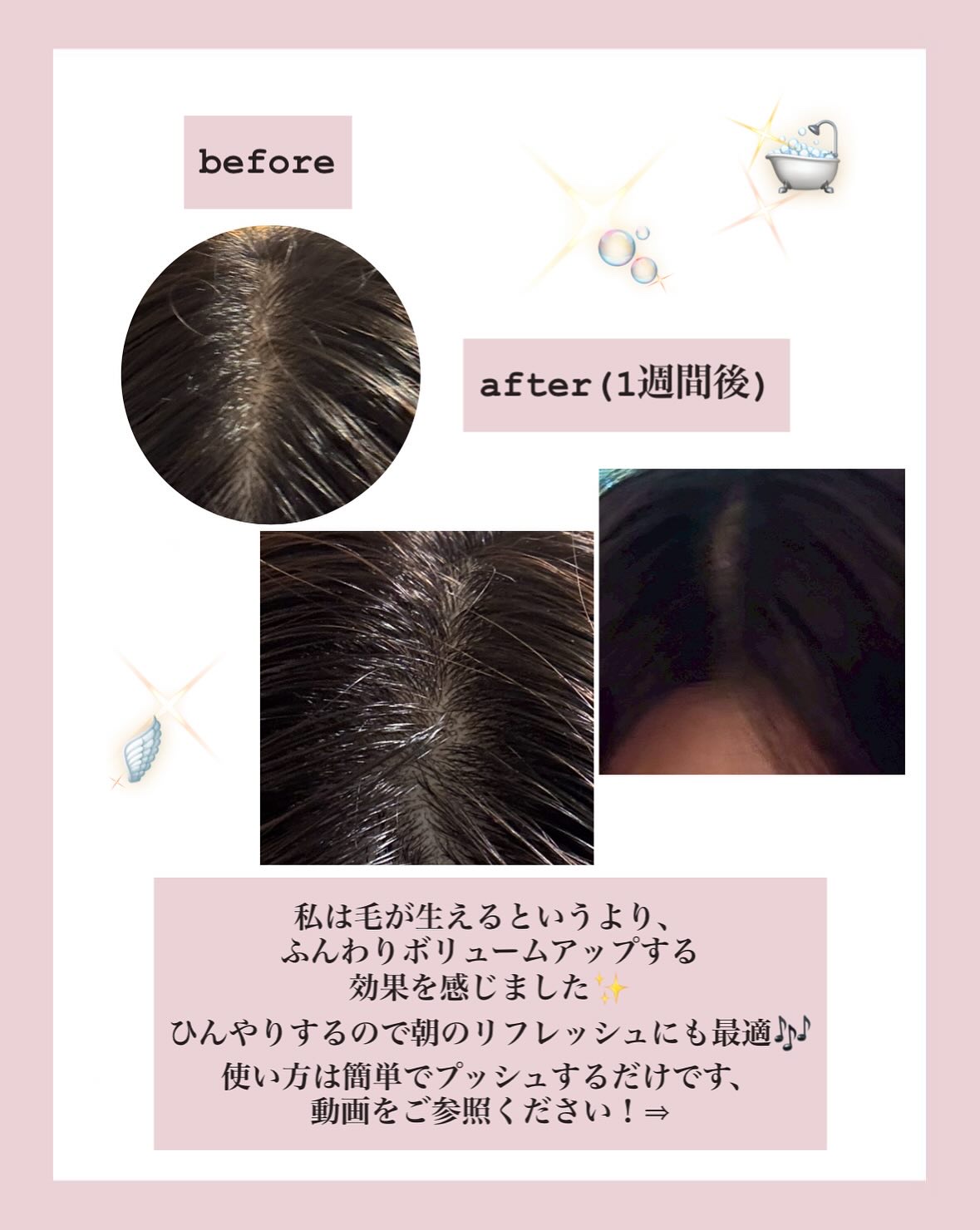 ボリューマイジング&スーディングヘアトニック/SallyZen/頭皮ローションを使ったクチコミ（3枚目）