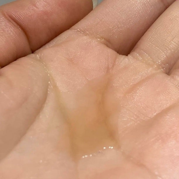 RXザ・アルファアルブチン2 ニキビ跡ケアセラム/COSRX/美容液を使ったクチコミ(5枚目)