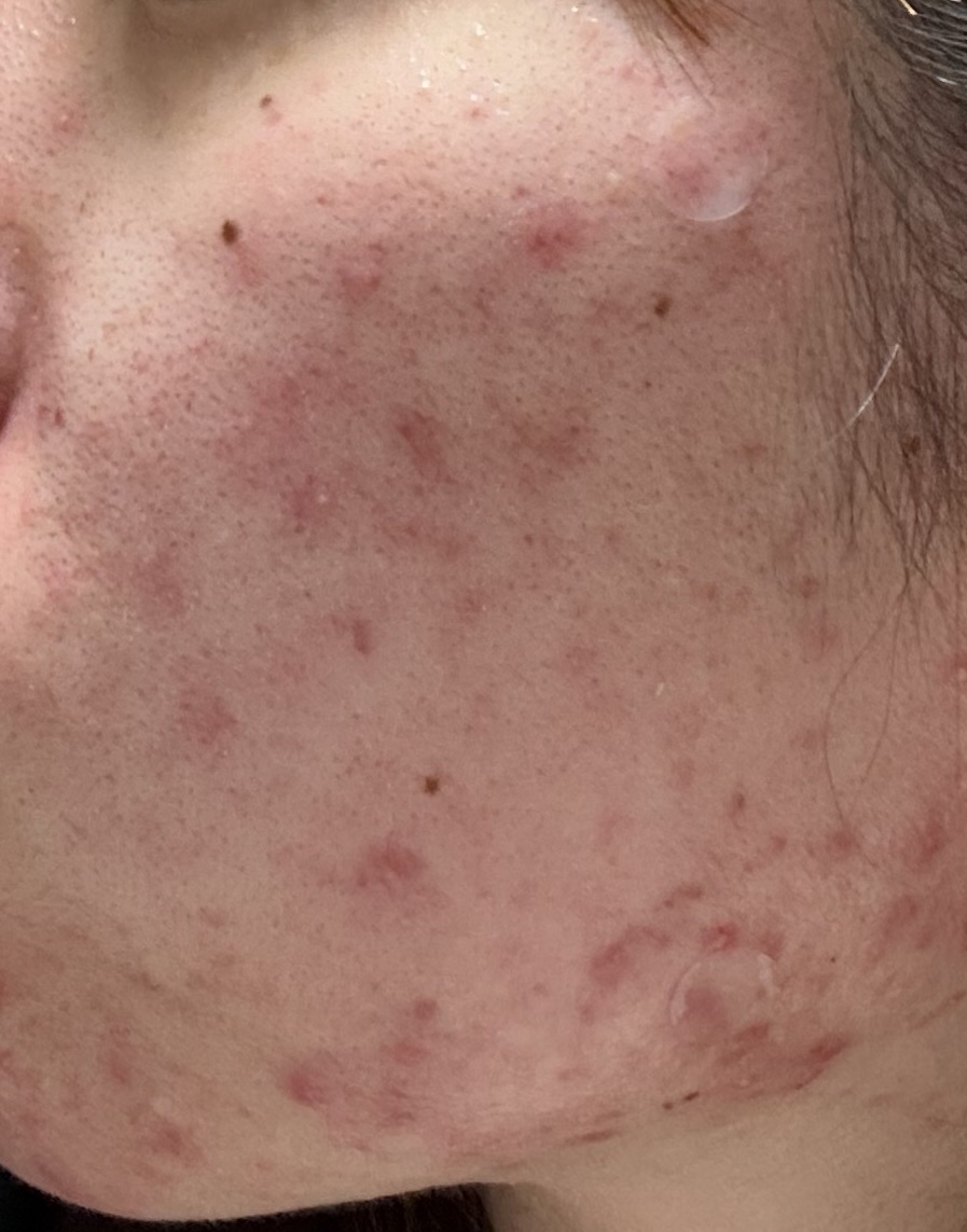 ソフティモ スピーディ クレンジングオイル/ソフティモ/オイルクレンジングを使ったクチコミ（2枚目）