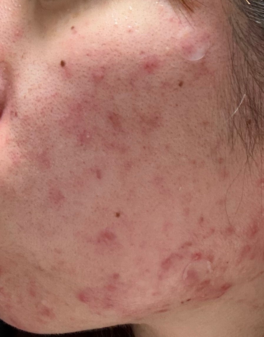 ソフティモ スピーディ クレンジングオイル/ソフティモ/オイルクレンジングを使ったクチコミ(2枚目)