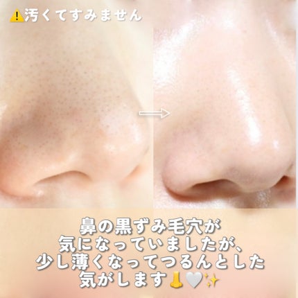 BnD マシュマロ コラーゲン AHA スクラブ /BnD/ボディスクラブを使ったクチコミ(5枚目)