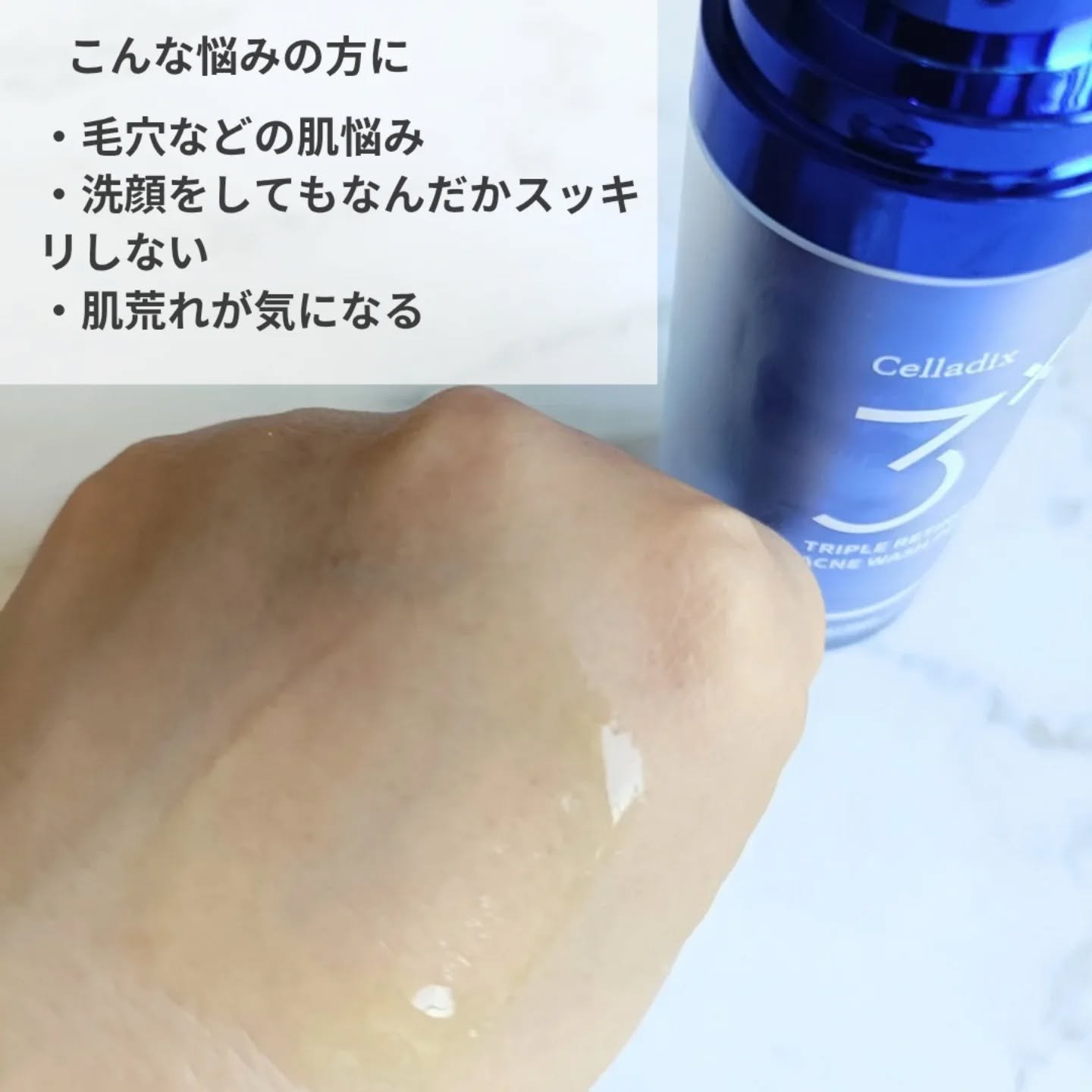 トリプル レチノール ウォッシュピール/Celladix/ピーリングを使ったクチコミ（3枚目）
