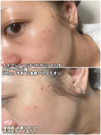 スピテラグルタチオンバブルクリーム/NUDIQUE/フェイスクリームを使ったクチコミ(4枚目)