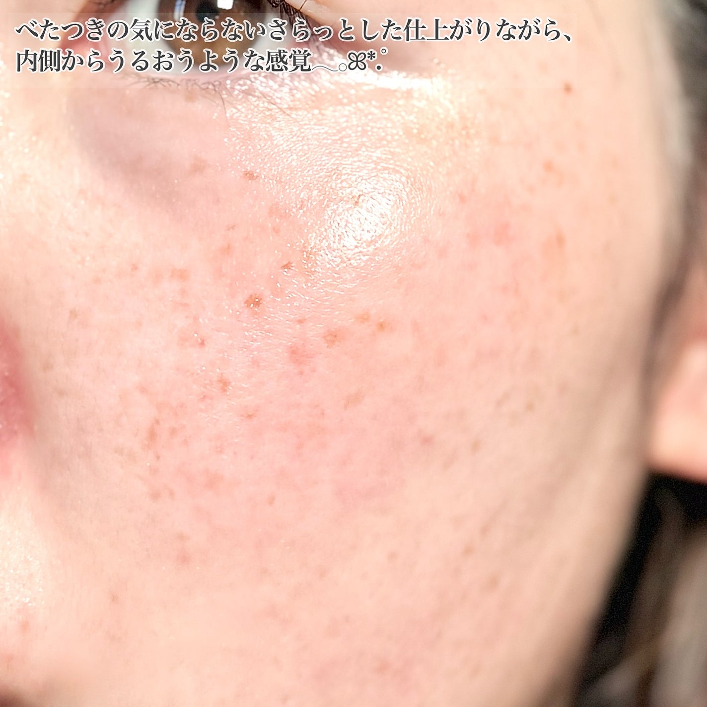 ReDRNエクソソームアンプル/Dr.nineteen/美容液を使ったクチコミ(6枚目)