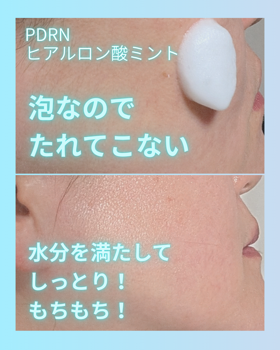 PDRN ヒアルロン酸 ミントマイクロバブルセラム/VT/美容液を使ったクチコミ（2枚目）