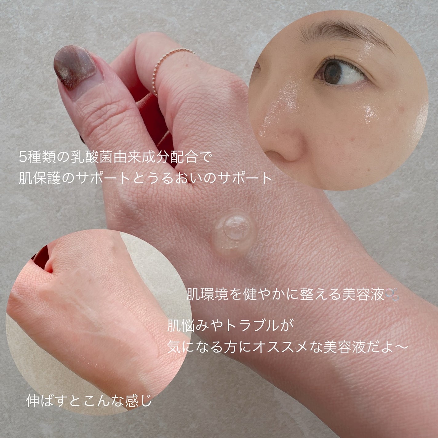 トラブルターゲティングセラム/EIOM/美容液を使ったクチコミ(3枚目)