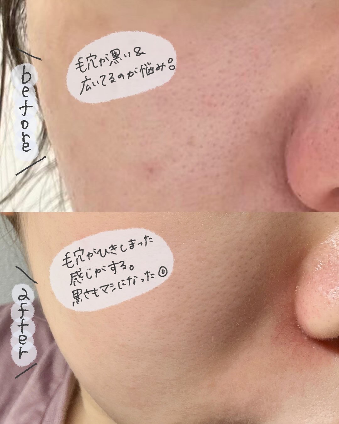 ペンタショット/CELORABY/美顔器・マッサージを使ったクチコミ（3枚目）