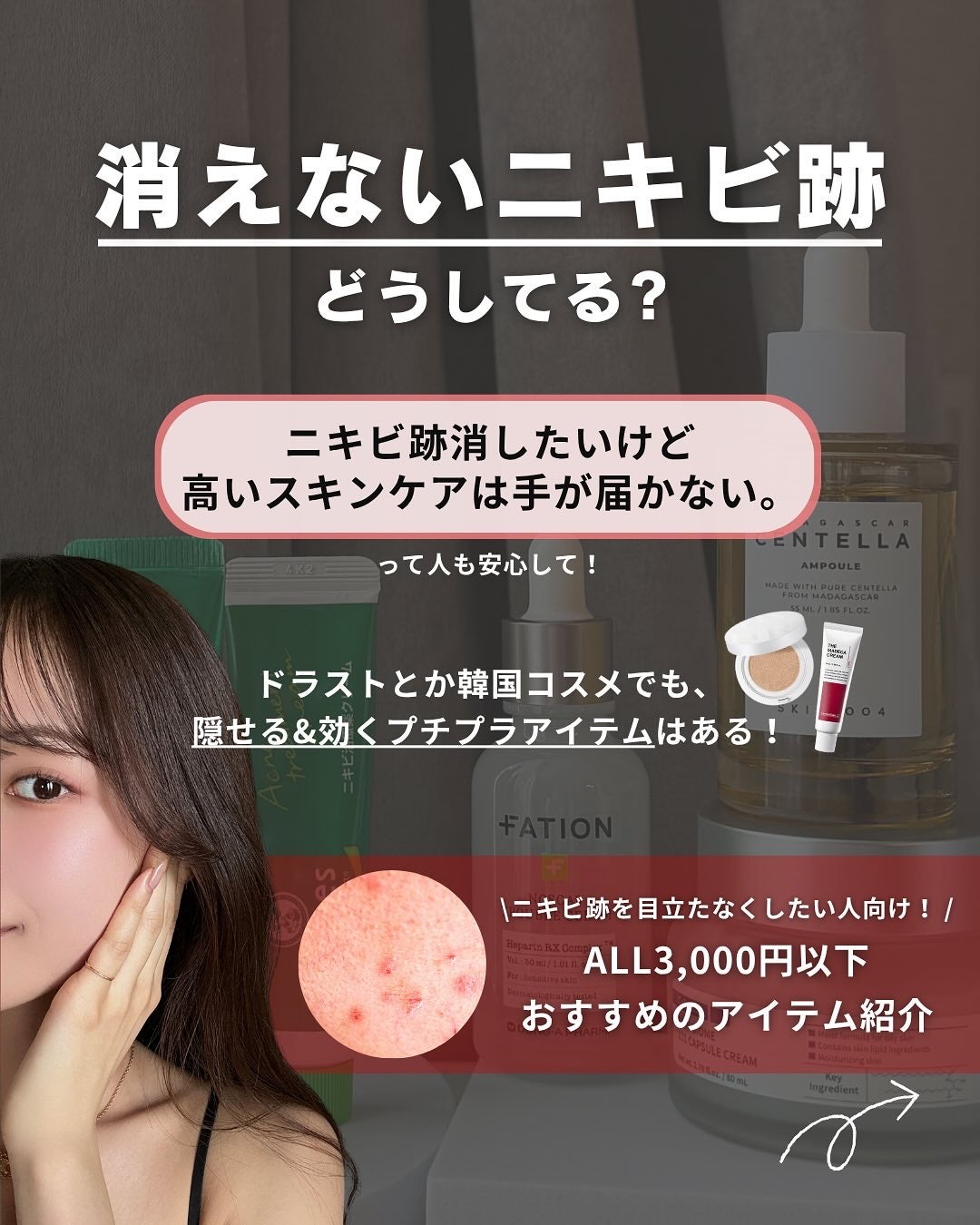 白湯(サユ) | ニキビと戦うOL🤍 on LIPS 「・白湯です🫶🏻ニキビやっと消えたのにニキビ跡残るっていう経験み..」(2枚目)
