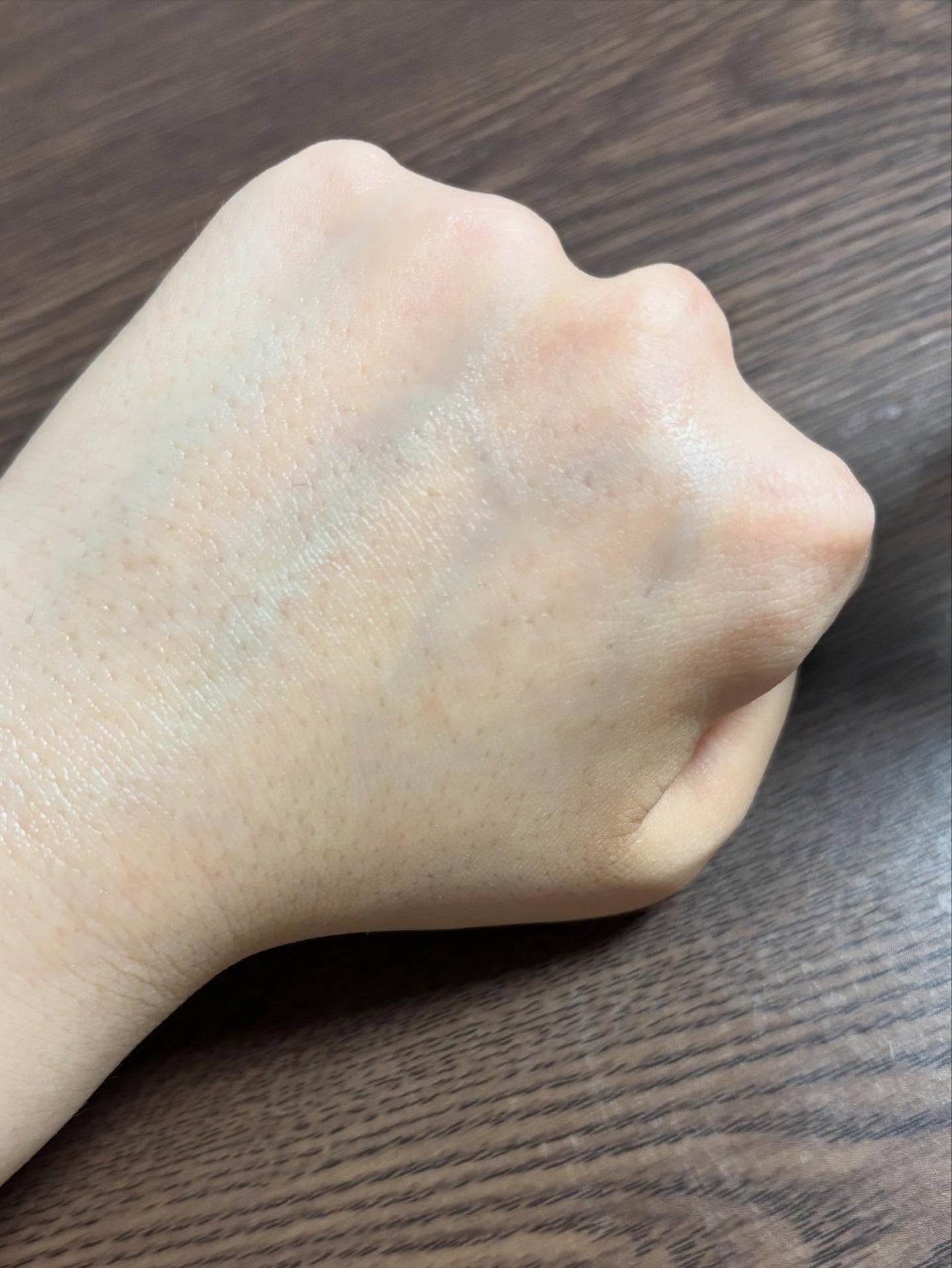 スキンブースティングフォルテセラム/essenciel/美容液を使ったクチコミ(3枚目)