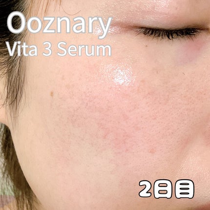 ビタ3セラム/オーズナリー/美容液を使ったクチコミ(6枚目)