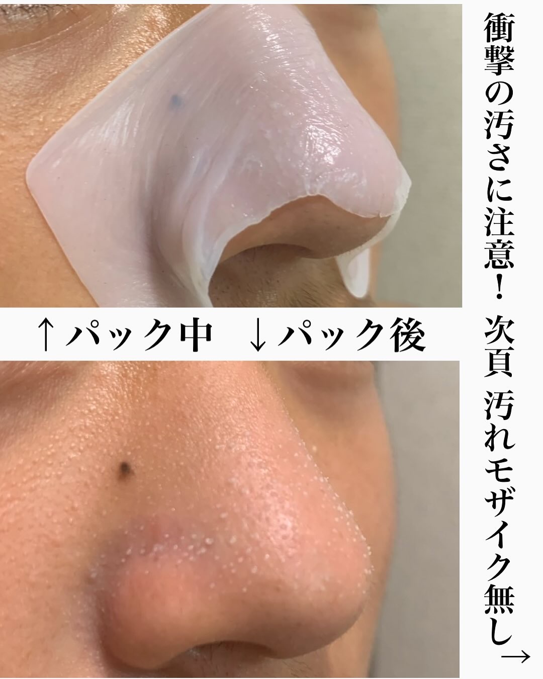 ディープクリーンマスター/ilso/その他スキンケアグッズを使ったクチコミ（2枚目）