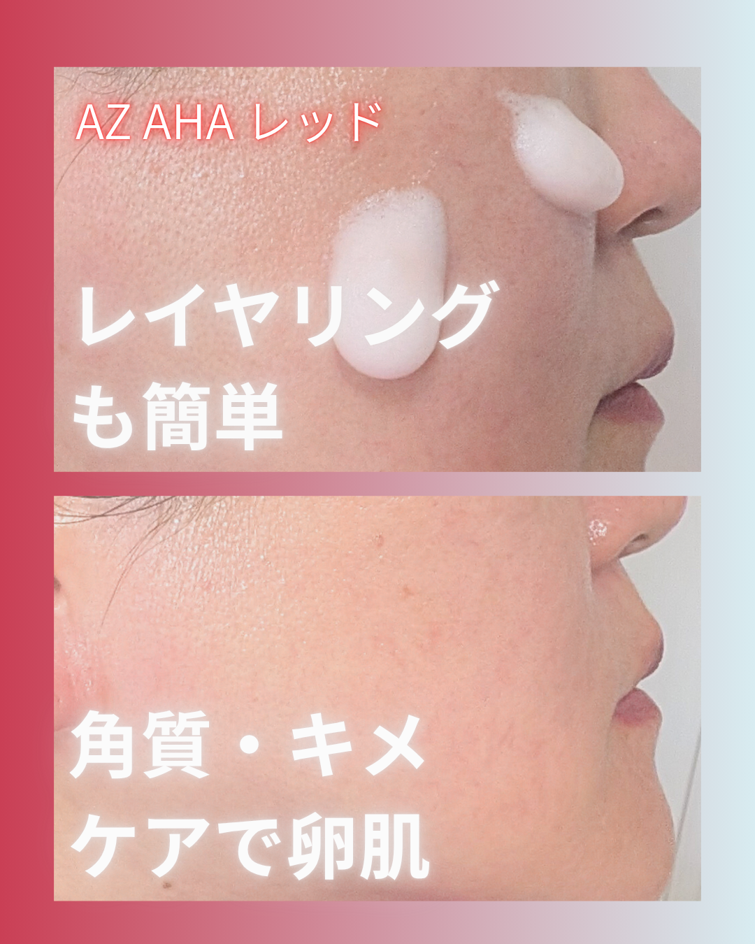 PDRN ヒアルロン酸 ミントマイクロバブルセラム/VT/美容液を使ったクチコミ（3枚目）