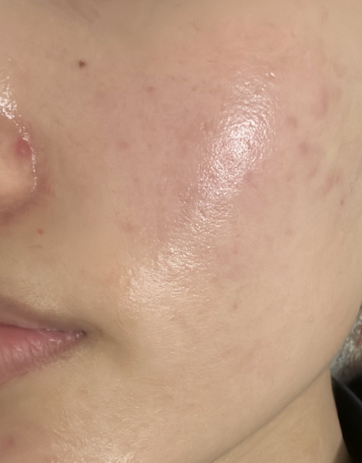 コラージュフルフル 泡石鹸/コラージュ/デリケートゾーンケアを使ったクチコミ（2枚目）