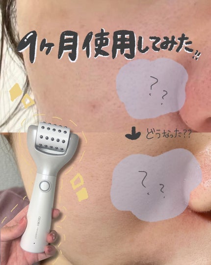 ペンタショット/CELORABY/美顔器・マッサージを使ったクチコミ(1枚目)