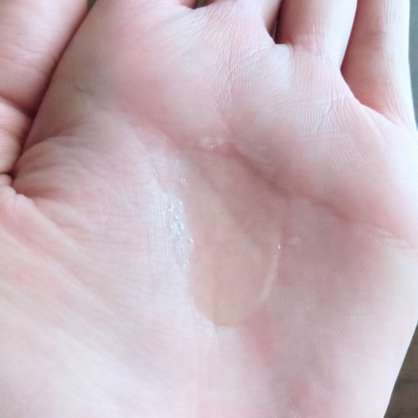 アゼライン酸AC化粧水 スタンダード/LEPOREM/ミスト状化粧水を使ったクチコミ(5枚目)