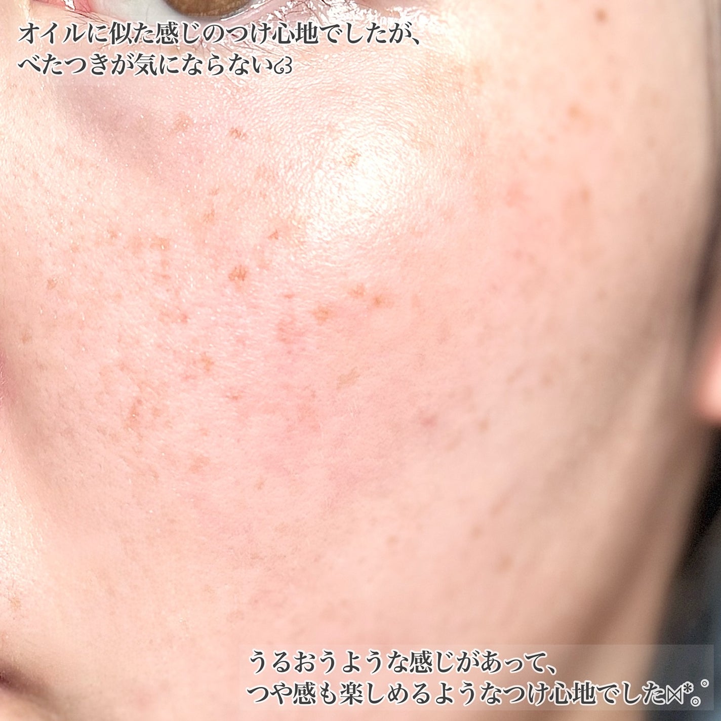 ビタプル ダブルアクション リペアセラム 15/VITAPURU/美容液を使ったクチコミ(5枚目)