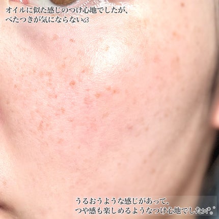 ビタプル ダブルアクション リペアセラム 15/VITAPURU/美容液を使ったクチコミ(5枚目)