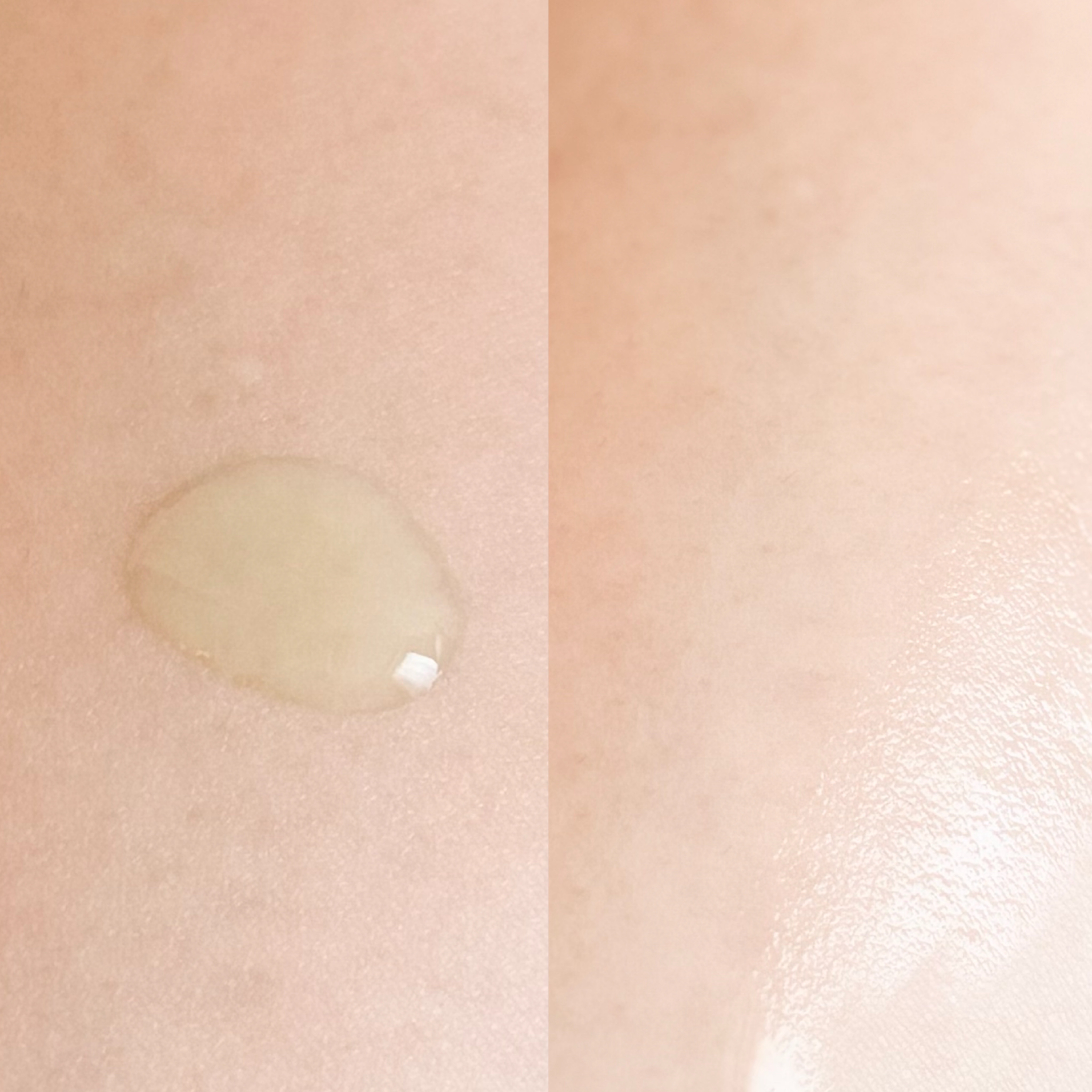 青麦ジンクセラム/Veganifect/美容液を使ったクチコミ（3枚目）