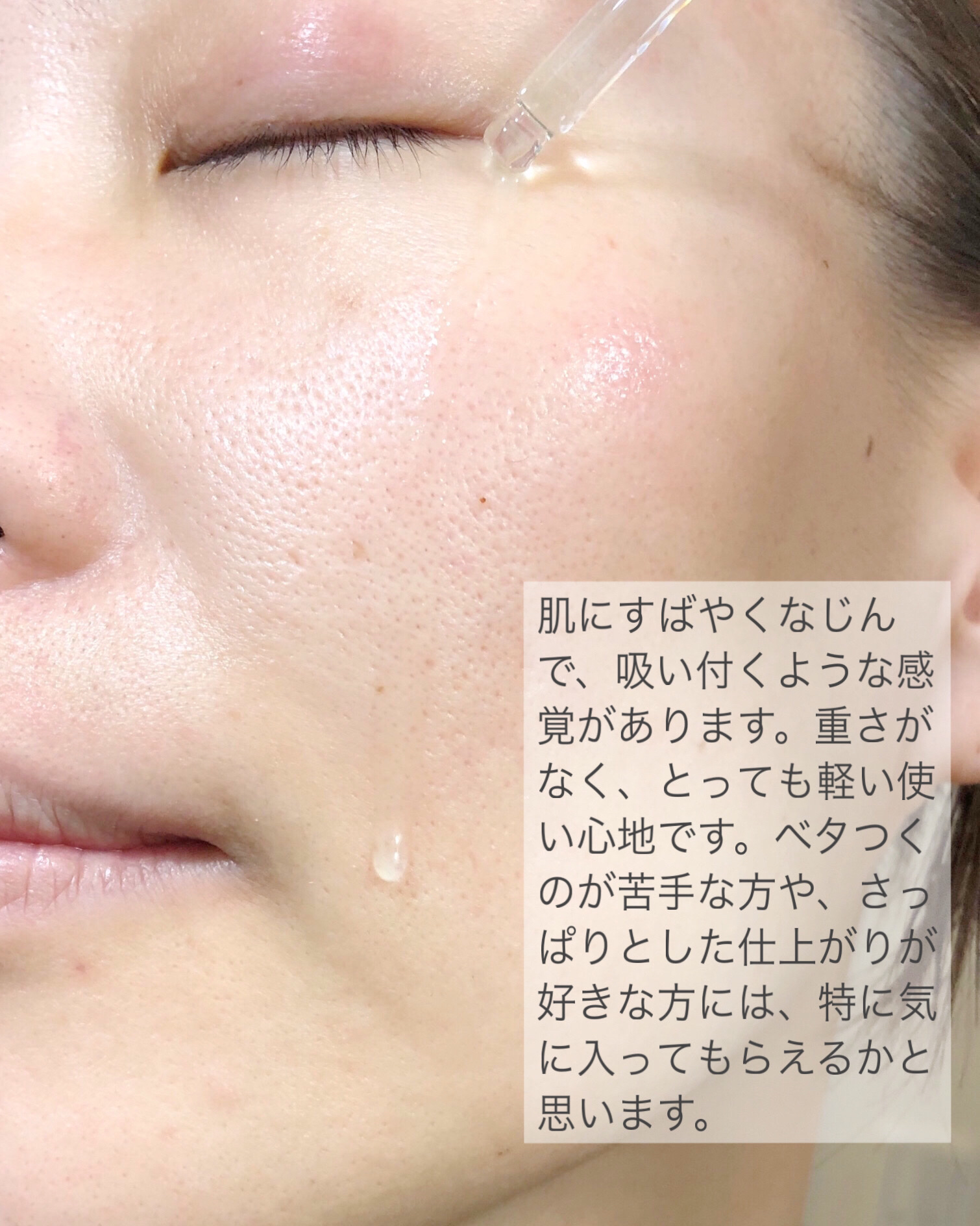 ダーマアンサーアゼライン酸ミントアンプル/CNP Laboratory/美容液を使ったクチコミ（3枚目）