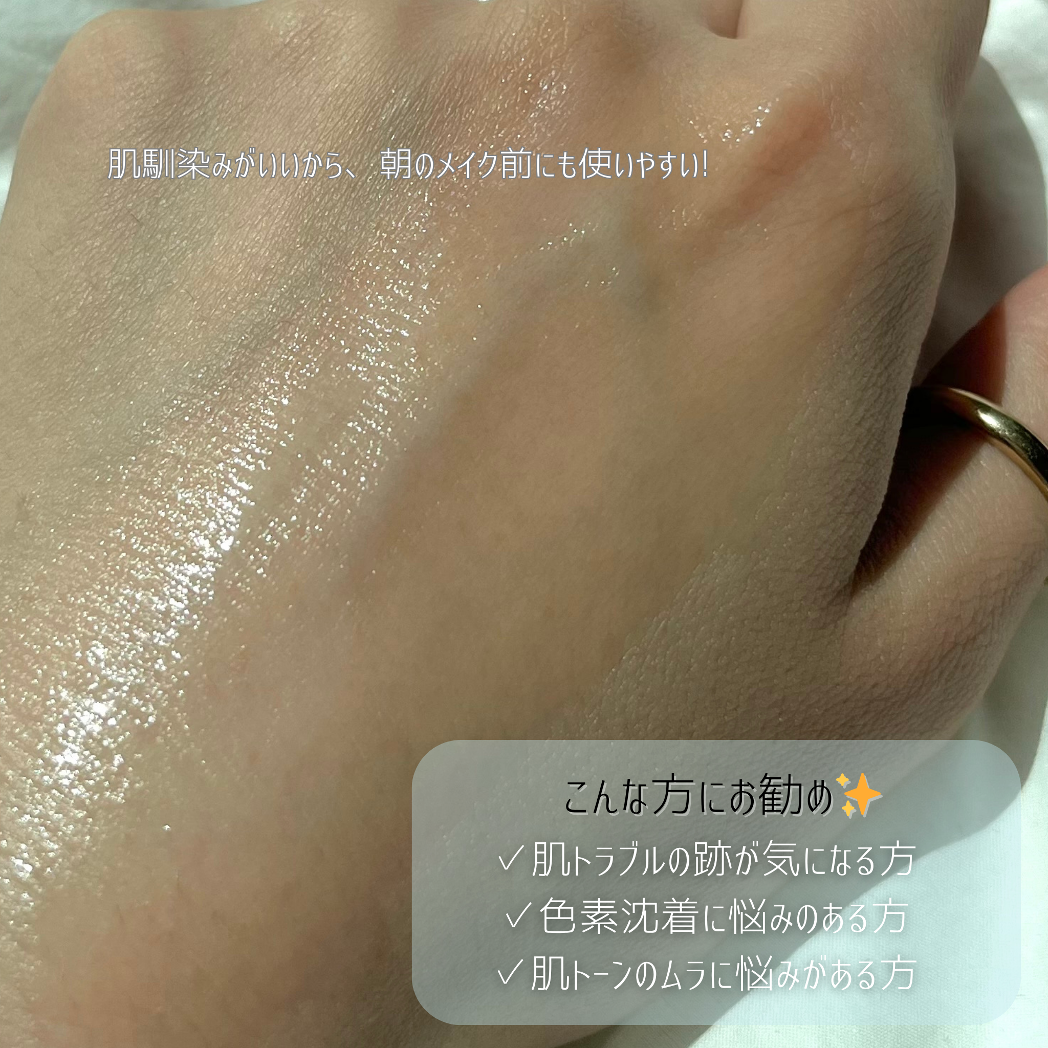 RXザ・アルファアルブチン2 ニキビ跡ケアセラム/COSRX/美容液を使ったクチコミ（3枚目）