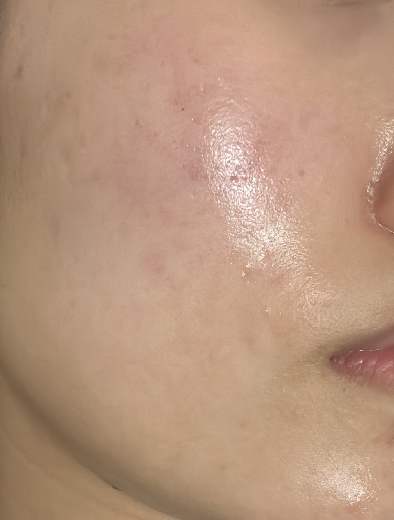 コラージュフルフル 泡石鹸/コラージュ/デリケートゾーンケアを使ったクチコミ（1枚目）