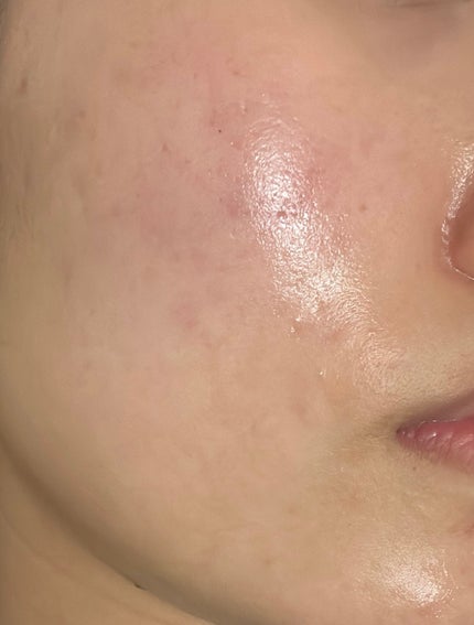 コラージュフルフル 泡石鹸/コラージュ/デリケートゾーンケアを使ったクチコミ(1枚目)