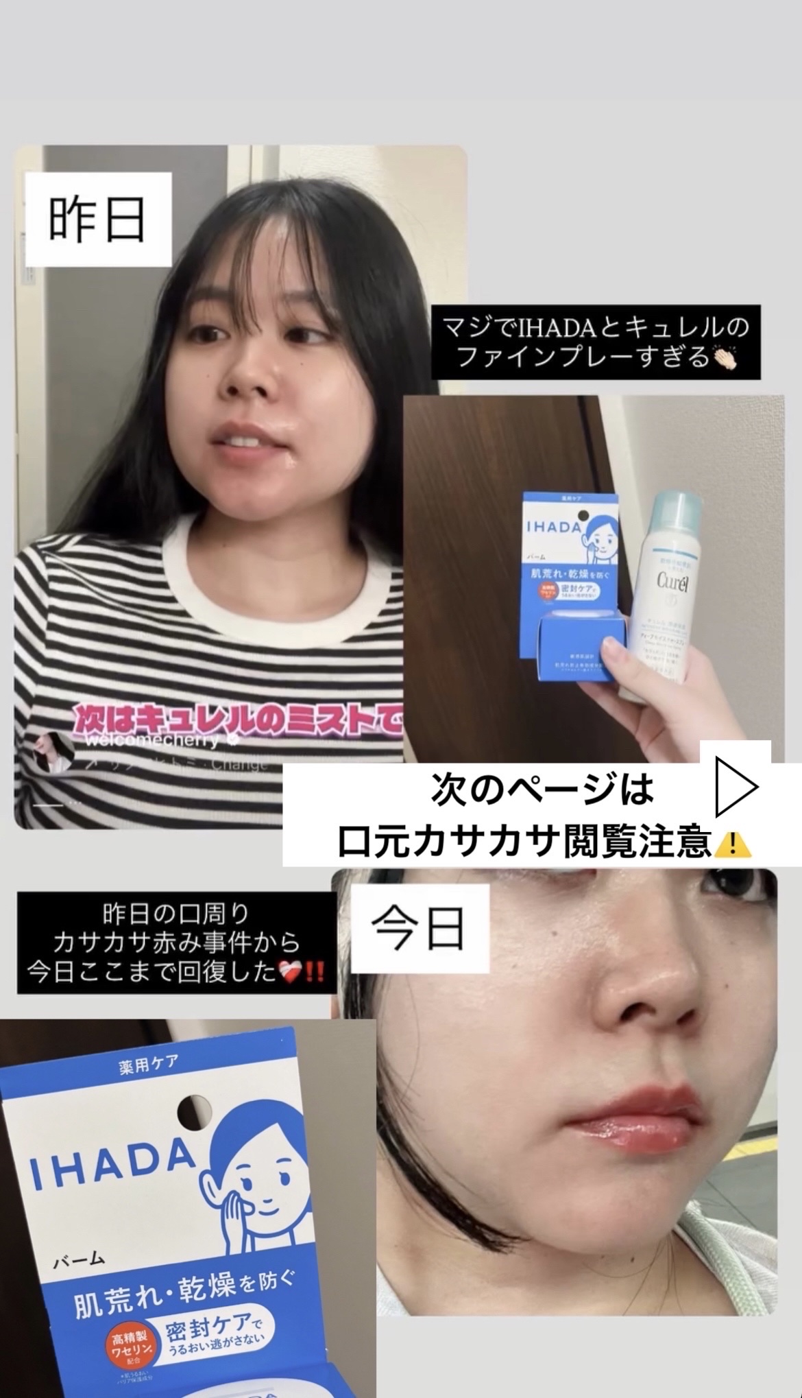イハダ 薬用バーム【医薬部外品】/IHADA/フェイスバームを使ったクチコミ（3枚目）