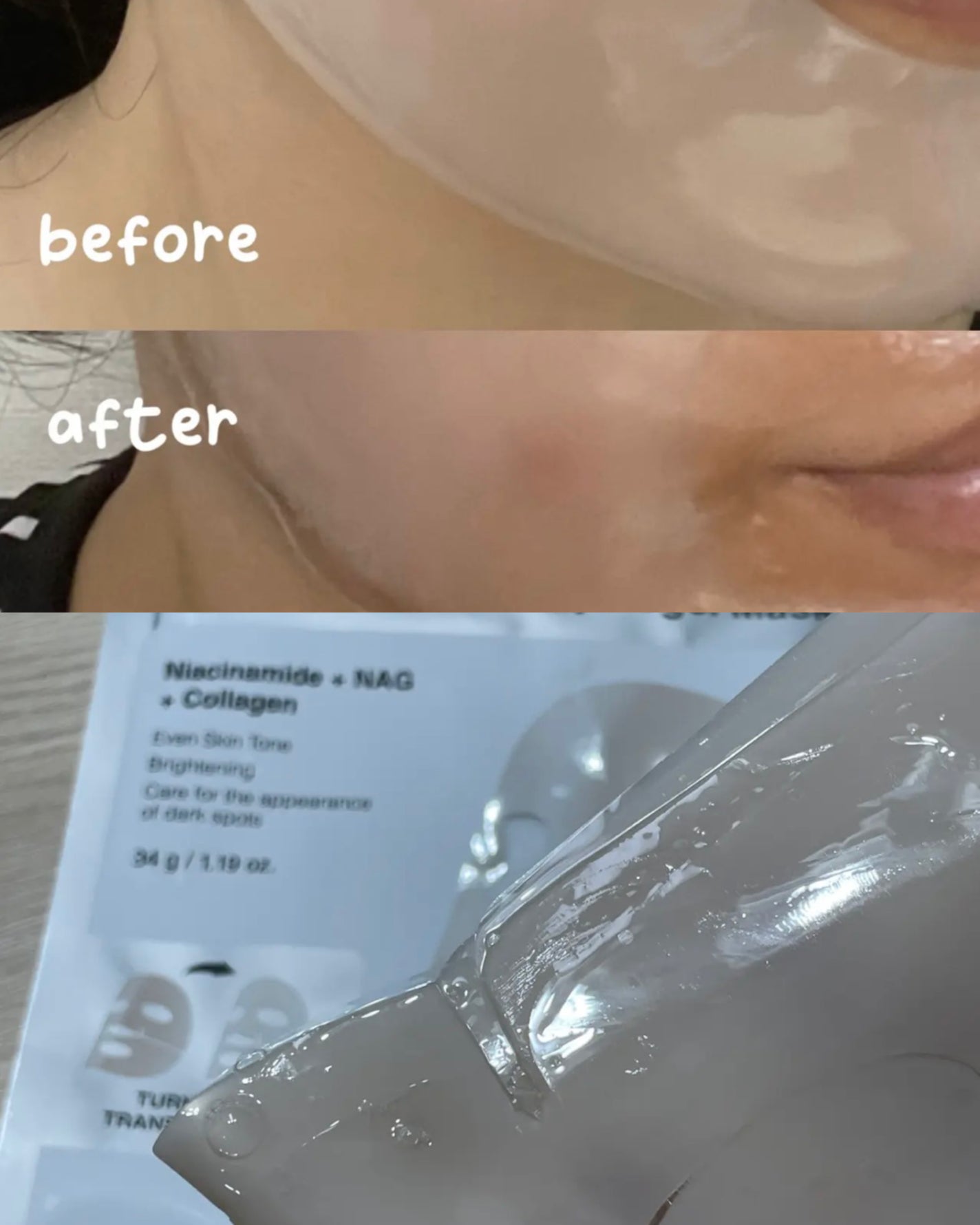 RXザ・アルファアルブチン2 ニキビ跡ケアセラム/COSRX/美容液を使ったクチコミ(2枚目)