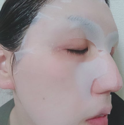 バイオームレメディポアリセットPDRN カーミングマスク/UIQ/シートマスク・パックを使ったクチコミ(2枚目)