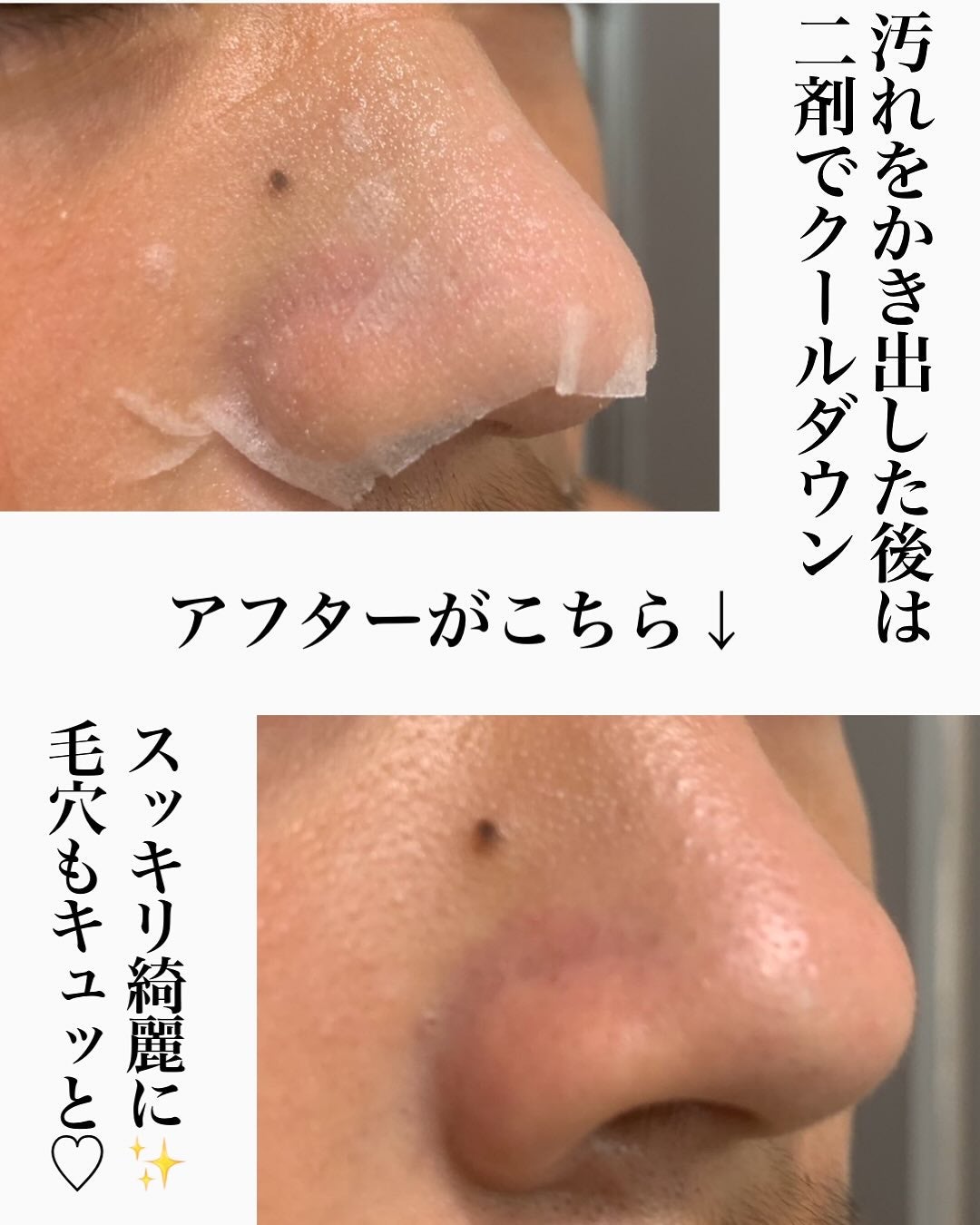 ナチュラルマイルドクリアノーズパック/ilso/シートマスク・パックを使ったクチコミ(4枚目)