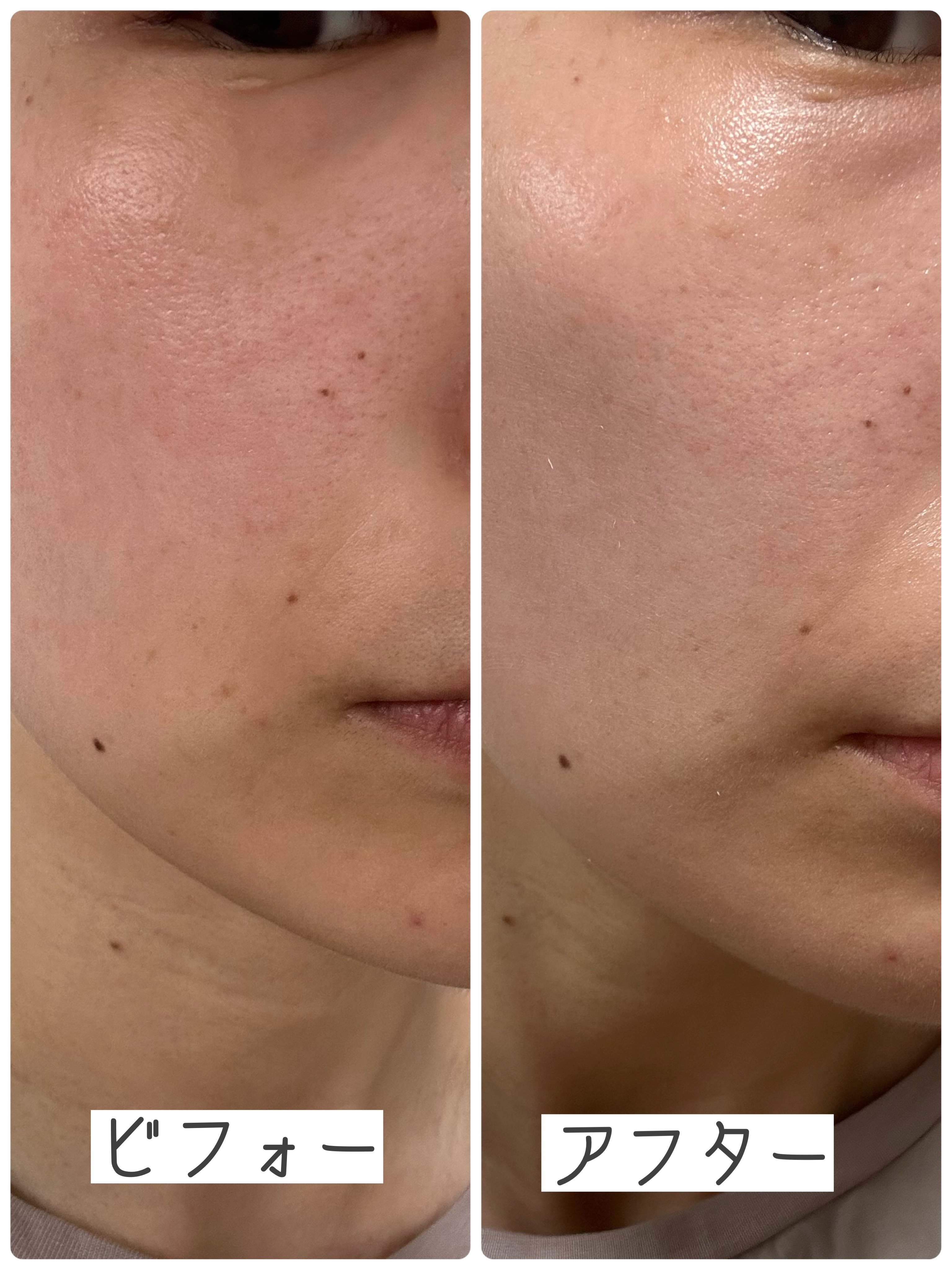 グロウスキンヴェール UV/favs/日焼け止めローションを使ったクチコミ（2枚目）