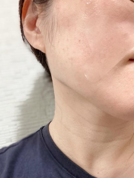 おやすみシワパッチ/ENSEMBLY/その他スキンケアを使ったクチコミ(4枚目)