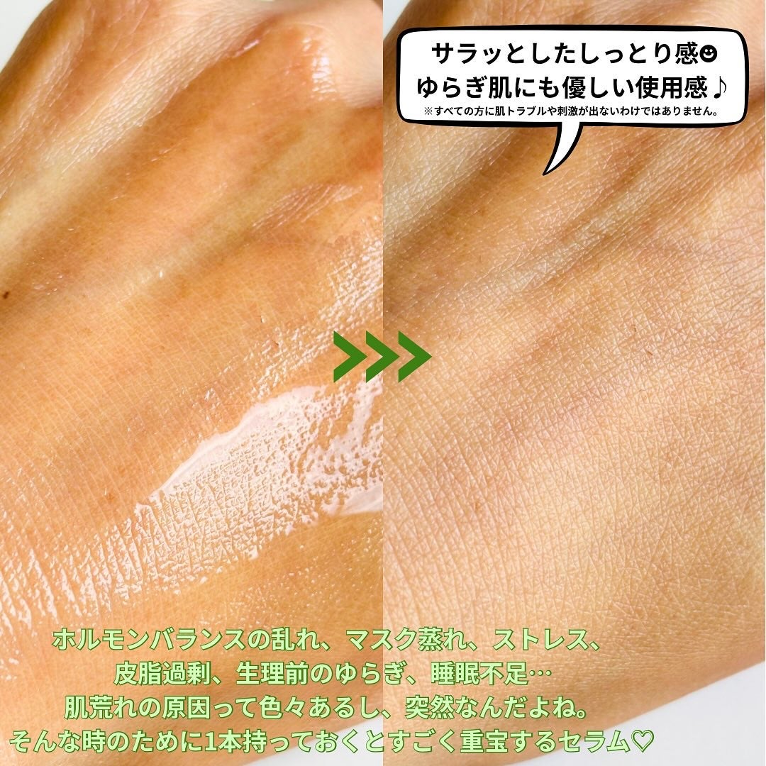 青麦ジンクセラム/Veganifect/美容液を使ったクチコミ(3枚目)