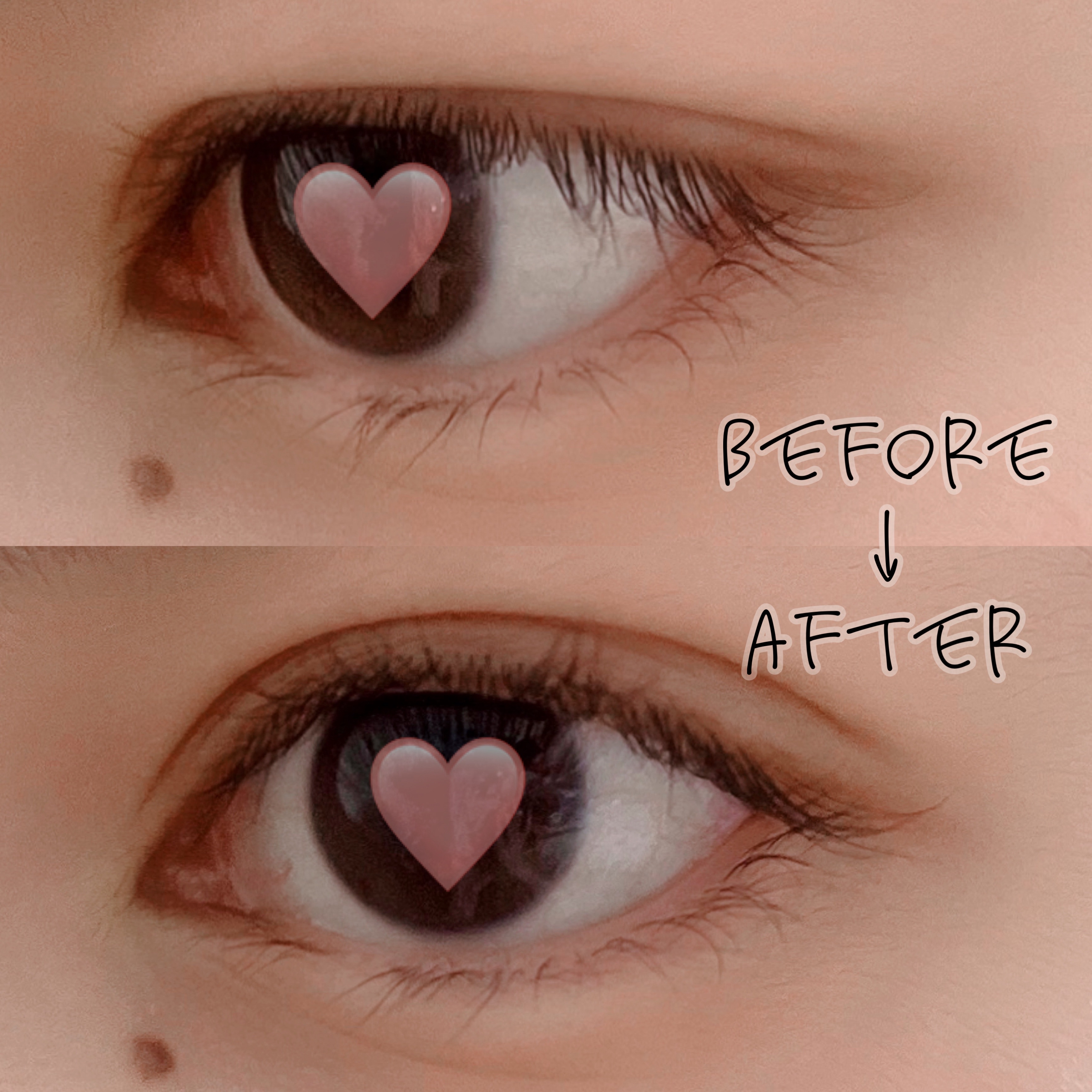 オリシキ アイリッドスキンフィルム EX/D-UP/二重まぶた用アイテムを使ったクチコミ（2枚目）