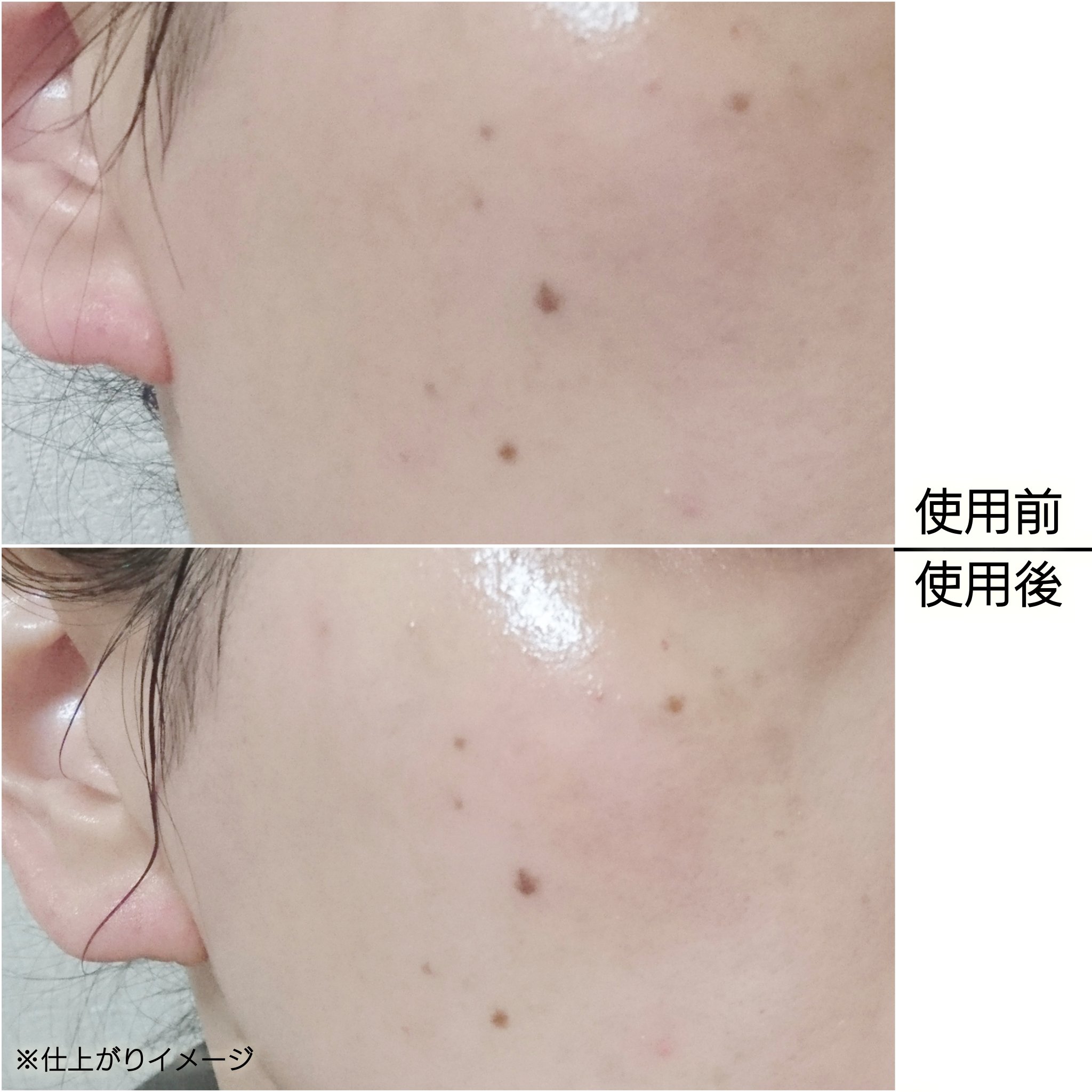 バイオームレメディポアリセットPDRN カーミングマスク/UIQ/シートマスク・パックを使ったクチコミ（3枚目）