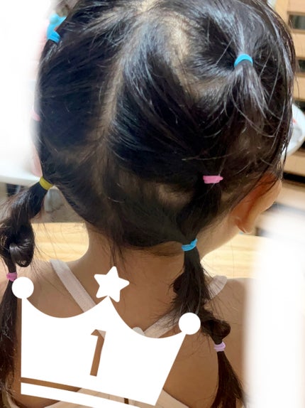 ヘアゴム/DAISO/ヘアアクセサリーを使ったクチコミ(1枚目)