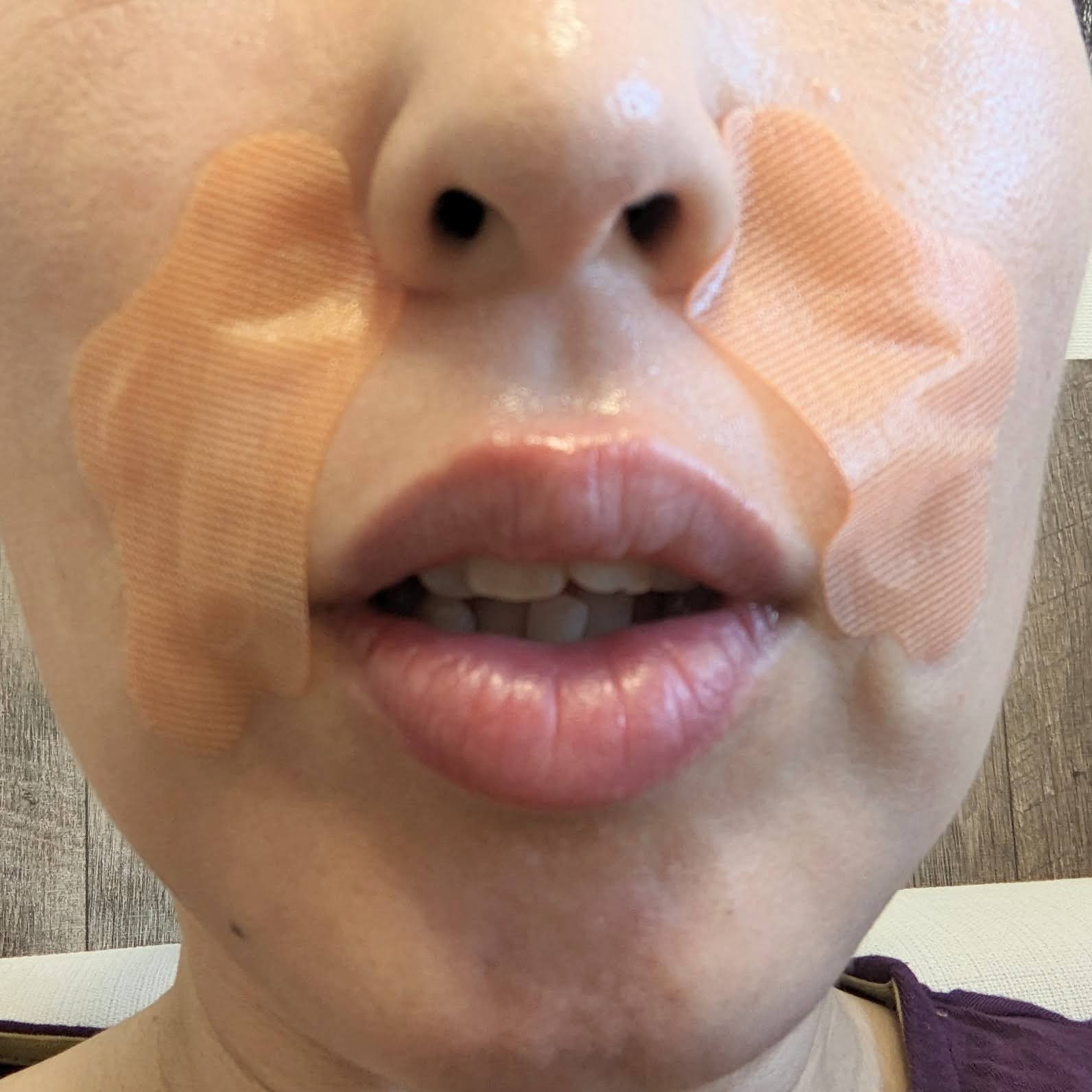 ダーマフィラースマイル お試し１回分(２枚×１袋)/Quanis/シートマスク・パックを使ったクチコミ（2枚目）